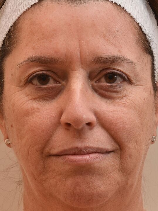 Also habe ich geschaut, bevor ich Eudalie Creme benutzte