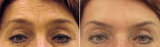 Feldfeld Verjüngung