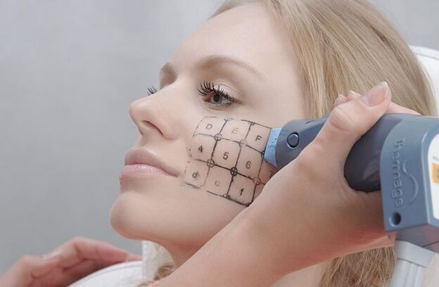 Thermisches Verfahren